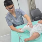 Clubfoot casting