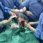 Limb lengthening procedure with ankle correction